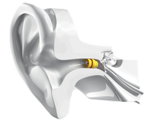 apparecchi per l'udito