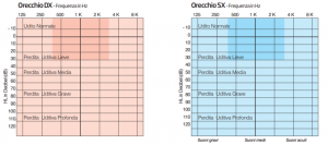 Grafico audiometrico